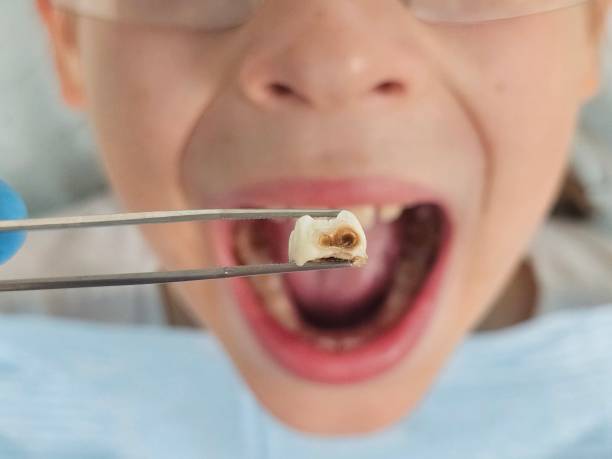 Best Walk-In Emergency Dentist in Pebble Creek, FL