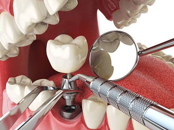 Best Emergency Dental Surgery in Pebble Creek, FL