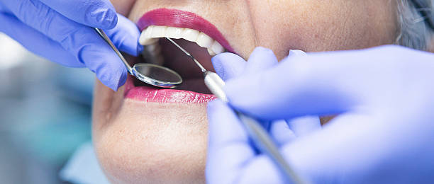 Best Emergency Broken Tooth Repair in Pebble Creek, FL